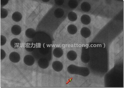 BGA因?yàn)楹笁|變小，造成錫膏過多而最終形成焊接短路的結(jié)果。